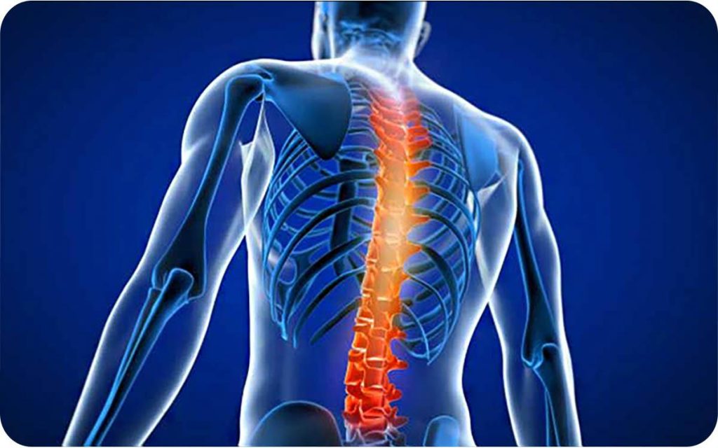 ویتامین و کمردرد