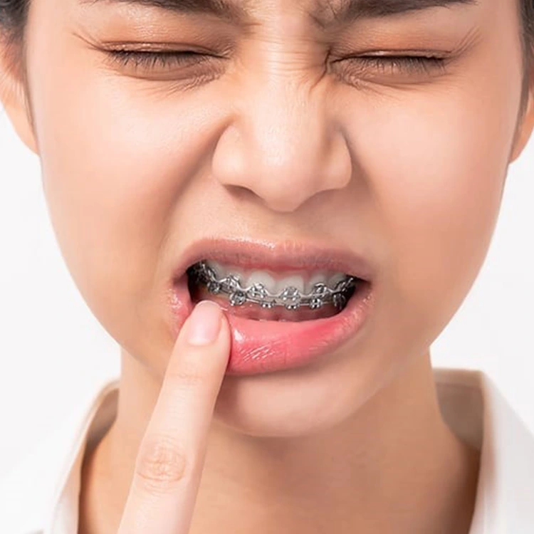 لق شدن دندان