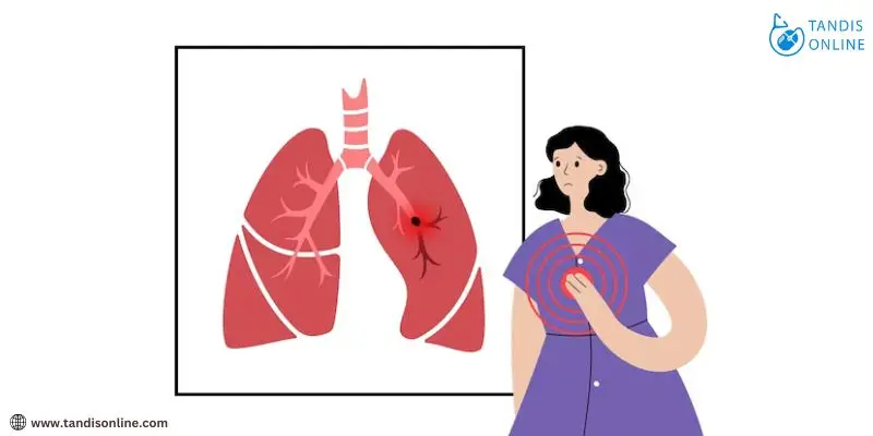 تشخصی آمبولی ریه